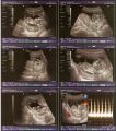 1er Echo 06.05.2008 800x600.jpg